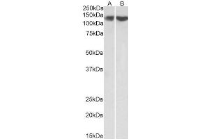 ABIN5539667 (0. (REST Antikörper  (Internal Region))
