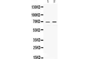 Observed bind size: 69KD (c-Rel Antikörper  (Middle Region))