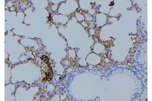 ABIN6275023 at 1/100 staining Mouse lung tissue by IHC-P. (COPZ1 Antikörper  (N-Term))