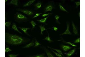 Immunofluorescence of monoclonal antibody to RPN1 on HeLa cell. (RPN1 Antikörper  (AA 24-607))