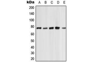 Western blot analysis of PKC zeta expression in HeLa (A), NIH3T3 (B), PC12 (C), rat kidney (D), rat heart (E) whole cell lysates. (PKC zeta Antikörper  (C-Term))