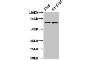 Western Blot Positive WB detected in: A549 whole cell lysate, SH-SY5Y whole cell lysate All lanes: MASP2 antibody at 2. (MASP2 Antikörper  (AA 189-314))