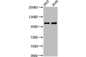 Western Blot Positive WB detected in: 293T whole cell lysate, A549 whole cell lysate All lanes: ICE2 antibody at 4. (NARG2 Antikörper  (AA 876-982))