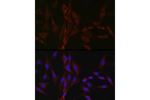 Immunofluorescence analysis of NIH/3T3 cells using CH Rabbit pAb (ABIN7266015) at dilution of 1:100 (40x lens).