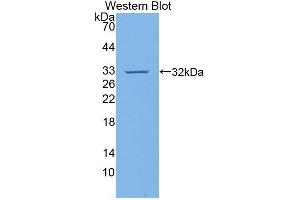 Western blot analysis of the recombinant protein. (VCAM1 Antikörper  (AA 369-658))