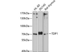 Western blot analysis of extracts of various cell lines, using TDP1 Antibody (ABIN1682992, ABIN3019238, ABIN3019239 and ABIN6220782) at 1:1000 dilution.