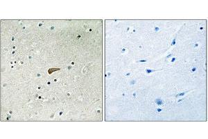Immunohistochemical analysis of paraffin-embedded human brain tissue using FRS2 (Phospho-Tyr436) antibody (left)or the same antibody preincubated with blocking peptide (right). (FRS2 Antikörper  (pTyr436))