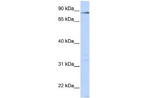 WB Suggested Anti-L3MBTL4 Antibody Titration:  0. (L3MBTL4 Antikörper  (N-Term))