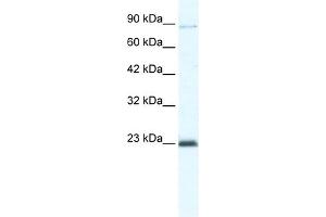 WB Suggested Anti-MCM4 Antibody Titration:  5. (MCM4 Antikörper  (C-Term))