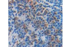 IHC-P analysis of Mouse Tissue, with DAB staining. (PRTN3 Antikörper  (AA 24-249))