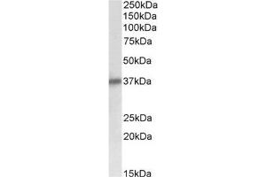 AP32139PU-N Delta-Sarcoglycan antibody staining of Human Heart lysate at 0. (SGCD Antikörper  (Internal Region))