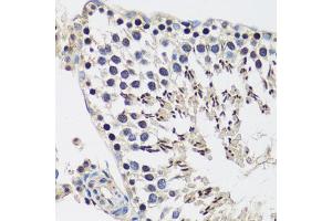 Immunohistochemistry of paraffin-embedded rat testis using C antibody (ABIN6127552, ABIN6137952, ABIN6137953 and ABIN6216977) at dilution of 1:100 (40x lens). (CASC5 Antikörper  (AA 1-300))