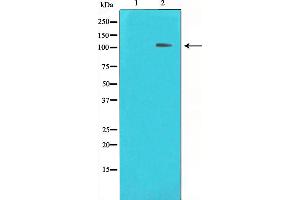 Western blot analysis on HeLa cell lysate using HDAC7 Antibody,The lane on the left is treated with the antigen-specific peptide. (HDAC7 Antikörper  (Internal Region))