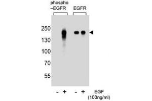 Western blot analysis of extracts from A431 cells, untreated or treated with EGF, using phospho-EGFR antibody (left) or nonphos Ab (right)