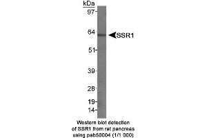 Image no. 1 for anti-Somatostatin Receptor 1 (SSTR1) (C-Term) antibody (ABIN363313) (SSTR1 Antikörper  (C-Term))