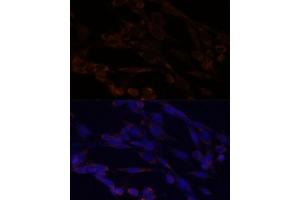 Immunofluorescence (IF) image for anti-conserved Helix-Loop-Helix Ubiquitous Kinase (CHUK) (C-Term) antibody (ABIN3022825)