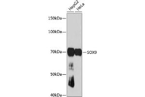 Western blot analysis of extracts of various cell lines, using SOX9 antibody (ABIN7270577) at 1:1000 dilution. (SOX9 Antikörper)