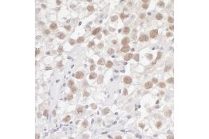 Immunohistochemistry (IHC) image for anti-Flap Structure-Specific Endonuclease 1 (FEN1) (AA 250-300) antibody (ABIN7454602) (FEN1 Antikörper  (AA 250-300))