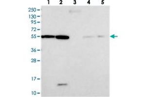 Western blot analysis of Lane 1: RT-4, Lane 2: U-251 MG, Lane 3: Human Plasma, Lane 4: Liver, Lane 5: Tonsil with DEPDC4 polyclonal antibody  at 1:250-1:500 dilution. (DEPDC4 Antikörper)