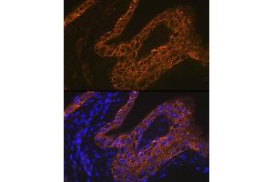 Immunofluorescence analysis of rat bladder using Cytokeratin 13 (KRT13) (KRT13) Rabbit mAb (ABIN7268089) at dilution of 1:100 (40x lens). (Cytokeratin 13 Antikörper)