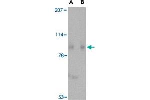 Western blot analysis of SLITRK1 in human brain tissue lysate with SLITRK1 polyclonal antibody  at (A) 1 and (B) 2 ug/mL . (SLITRK1 Antikörper  (C-Term))