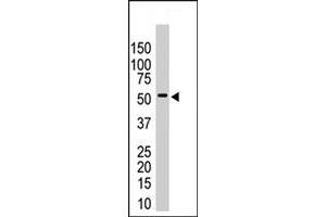 The USP14 polyclonal antibody  is used in Western blot to detect USP14 in HeLa cell lysates . (USP14 Antikörper  (N-Term))