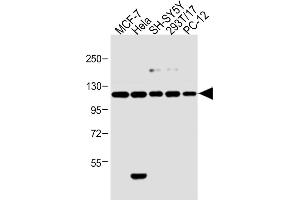 All lanes : Anti-Insulin Receptor R Antibody (N-term) at 1:2000 dilution Lane 1: 293T/17 whole cell lysate Lane 2: Hela whole cell lysate Lane 3: MCF-7 whole cell lysate Lane 4: PC-12 whole cell lysate Lane 5: SH-SY5Y whole cell lysate Lysates/proteins at 20 μg per lane. (Insulin Receptor Antikörper  (N-Term))