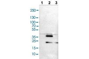 Western blot analysis of Lane 1: NIH/3T3 cell lysate, Lane 2: NBT-II cell lysate, and Lane 3: PC-12 cell lysate with CRKL polyclonal antibody . (CrkL Antikörper  (AA 125-301))