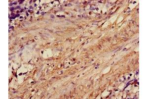 Immunohistochemistry (IHC) image for anti-Actin-Related Protein T1 (ACTRT1) (AA 201-376) antibody (ABIN7143116)