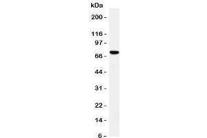 Westrn blot testing of HIF-3 alpha antibody and rat brain tissue lysate. (HIF3A Antikörper  (C-Term))