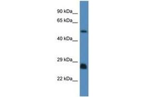 Image no. 1 for anti-SHC (Src Homology 2 Domain Containing) Transforming Protein 3 (SHC3) (AA 85-134) antibody (ABIN6746482) (SHC3 Antikörper  (AA 85-134))