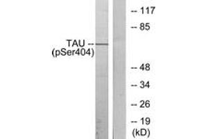Western blot analysis of extracts from 293 cells treated with UV, using Tau (Phospho-Ser404) Antibody. (tau Antikörper  (pSer721))