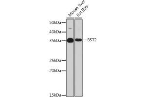 Western blot analysis of extracts of various cell lines, using BST2 Rabbit mAb (ABIN7265893) at 1:1000 dilution. (BST2 Antikörper)