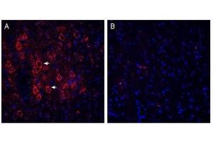 Expression of VGLUT2 in rat parietal cortex. (Solute Carrier Family 17 (Vesicular Glutamate Transporter), Member 6 (SLC17A6) (AA 45-56), (Cytosolic), (N-Term) Antikörper)
