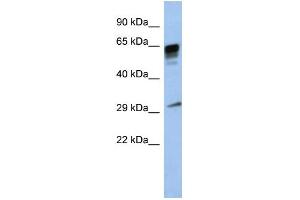 WB Suggested Anti-PRR18 Antibody Titration: 0. (Proline Rich 18 Antikörper  (Middle Region))