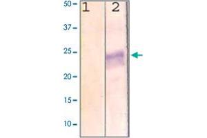 The cell lysate derived from MCF-7 was immunoprobed by RHO polyclonal antibody  at 1 : 500. (Rho-related GTP-binding protein Antikörper  (C-Term))
