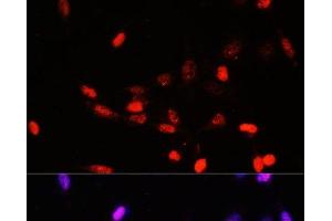 Immunofluorescence analysis of NIH/3T3 cells using COPS5 Polyclonal Antibody at dilution of 1:100. (COPS5 Antikörper)