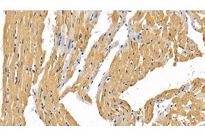 Detection of RIPK1 in Rat Cardiac Muscle Tissue using Polyclonal Antibody to Receptor Interacting Serine Threonine Kinase 1 (RIPK1) (RIPK1 Antikörper  (AA 1-179))