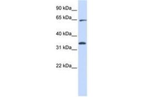 Image no. 1 for anti-Ras Homolog Gene Family, Member T1 (RHOT1) (AA 396-445) antibody (ABIN6740909) (RHOT1 Antikörper  (AA 396-445))