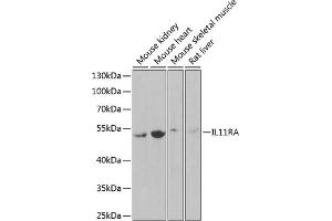 Western blot analysis of extracts of various cell lines, using IL11RA Antibody (ABIN6129037, ABIN6142294, ABIN6142295 and ABIN6222319) at 1:1000 dilution. (IL11RA Antikörper  (AA 30-290))