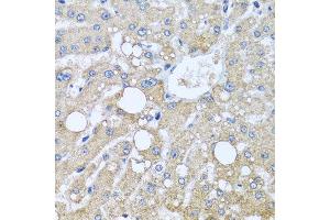 Immunohistochemistry of paraffin-embedded human liver injury using TUBGCP3 antibody at dilution of 1:100 (x40 lens). (TUBGCP3 Antikörper)