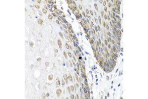 Immunohistochemistry of paraffin-embedded human esophagus using ANGPT1 antibody (ABIN5974767) at dilution of 1/100 (40x lens).