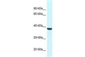 Image no. 1 for anti-WD Repeat Domain 45B (WDR45B) (AA 65-114) antibody (ABIN6747425) (WD Repeat Domain 45B (WDR45B) (AA 65-114) Antikörper)