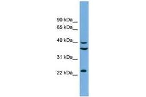 Image no. 1 for anti-SUMO1 Activating Enzyme Subunit 1 (SAE1) (AA 71-120) antibody (ABIN6743622) (SAE1 Antikörper  (AA 71-120))