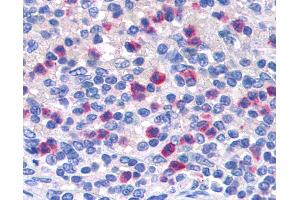 Anti-PGLYRP1 / PGRP antibody IHC of human spleen. (PGLYRP1 Antikörper  (AA 179-189))