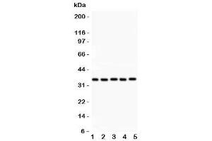 Western blot testing of HOXA11 antibody and Lane 1:  rat brain (Homeobox A11 Antikörper  (AA 74-245))