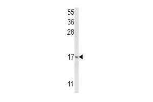 Western blot analysis of LTC4S Antibody (N-term) (ABIN652524 and ABIN2842352) in NCI- cell line lysates (35 μg/lane). (LTC4S Antikörper  (N-Term))