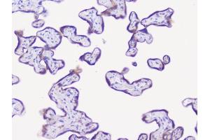 IHC analysis of NSE using anti-NSE antibody (ABIN6719549). (ENO2/NSE Antikörper)