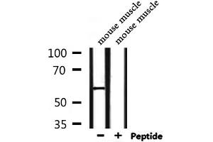 Western blot analysis of extracts from mouse muscle, using CD151 Antibody. (CD151 Antikörper  (N-Term))