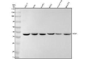 Western blot analysis of PCBP1 using anti-PCBP1 antibody (ABIN7605876).